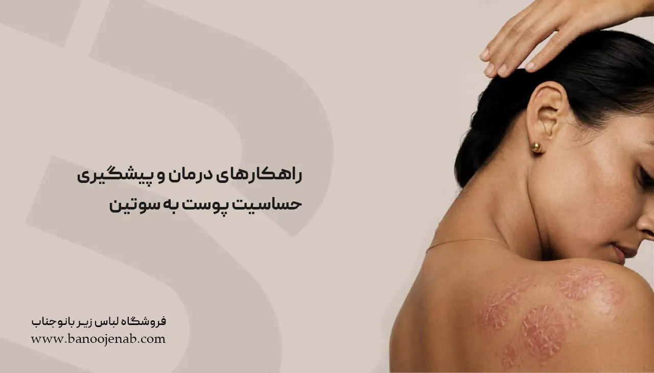 راهکارهای درمان و پیشگیری حساسیت پوست به سوتین